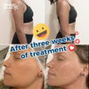 New 9d Smas Hifu Tighten Facial Weight Loss Slimming Machine