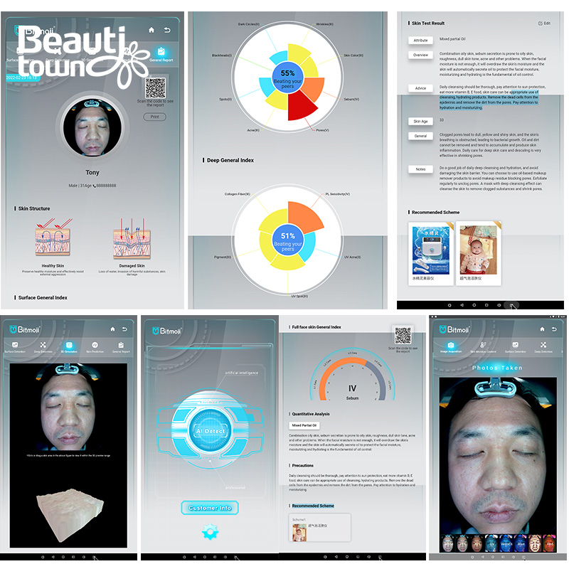 Skin Analyzer 2021 3D Accurate Simulation Technology